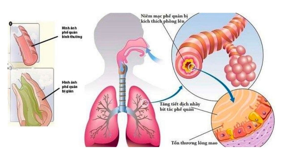 hen-phe-quan-co-lay-khong-2