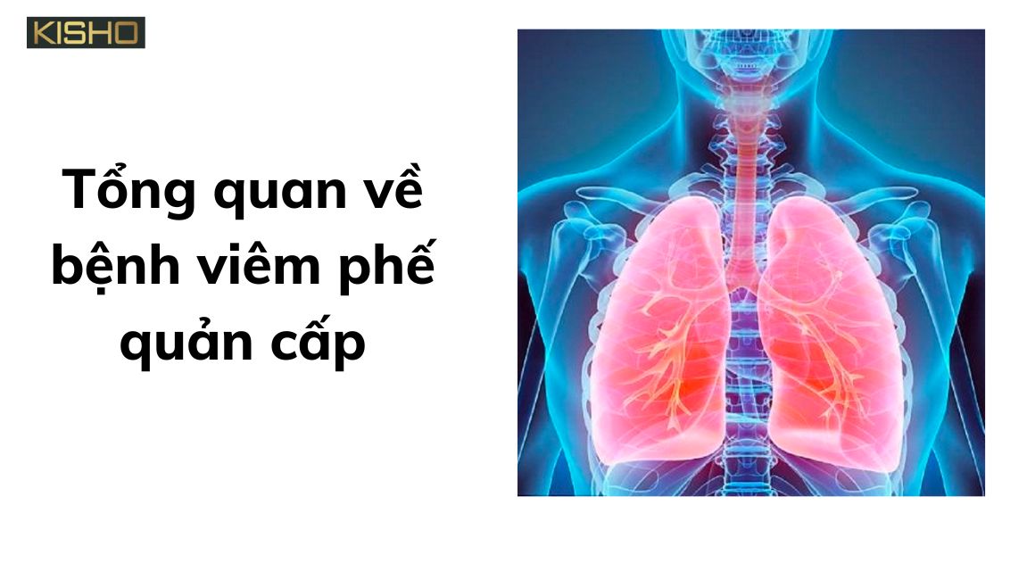 benh-viem-phe-quan-cap-1